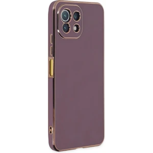 Xiaomi Mi 11 Lite Kılıf Olive Plated Lila