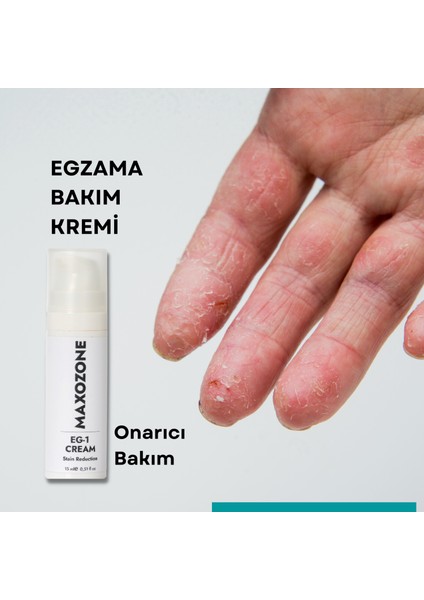 Egzama Kremi Eg1 15ML