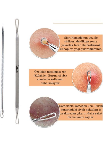 Siyah Nokta, ve Aparatı Komedon Seti - %100 Paslanmaz Çelik