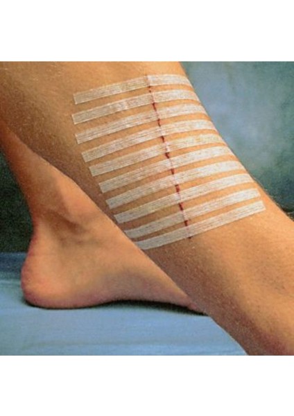 Hartmann Omnistrip Steri Strip Dikiş Bandı 6x101mm 10paket