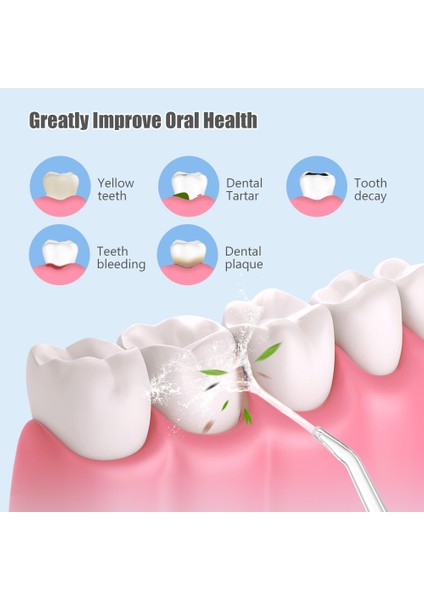Taşınabilir Temizleyici Diş Su Jeti (Yurt Dışından)