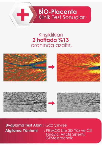 Gözaltı Torbaları ve Kırışıklık Karşıtı Göz Çevresi Renew Eye Serum