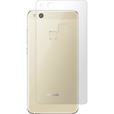 Microcase Huawei P10 Lite Full Arka Kaplama TPU Soft Filmi