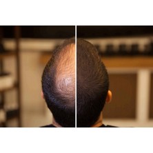 Fixplant Siyah 1 Şişe 28 Gr. Saç Tozu + Fixator Sabitleyici Sprey + Fixdeep Suda Çıkmayan Saç Dolgunlaştırıcı Pudra