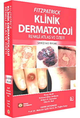 Fıtzpatrıck Klinik Dermatoloji Renkli Atlas ve Özeti