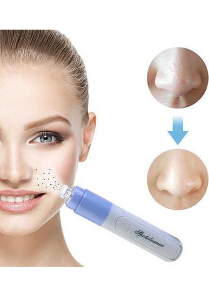 Mandarin Pore Cleaner Temizleme Vakumlu Siyah Nokta Temizleme