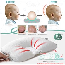 Halzey Düz Kafa Yastığı 0-3 Yaş Kafa Şekillendirici Yastık Ayarlanabilir Bebek Yastığı Düz Kafa Sendromu
