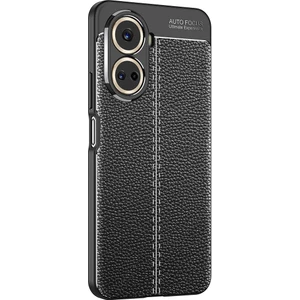 Kny Huawei Nova 10 Se Kılıf Deri Desenli Lux Niss Silikon