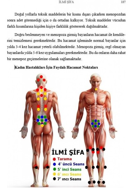 Hacamat Ile Hastalıkların Tedavisi - Murat Özmek (Ciltli)