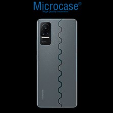 Microcase Huawei Nova 10 Pro Ön Arka Yan Koruma Full Body Film - FL360