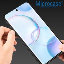 Microcase Honor 70 Fabrik Serisi Kumaş Desen Kılıf - AL3361