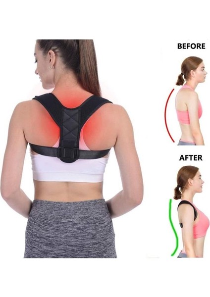 Ankaflex Vücut Doğru Durma Omuz Sırt Bel Korsesi Medoğrual Ortopedoğru Doğru Durus Korse