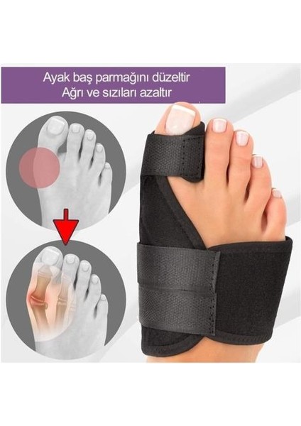 Halluks Ayak Ateli Ayak Başparmak Kemiği Çıkıntısı Bunyonu Düzeltici