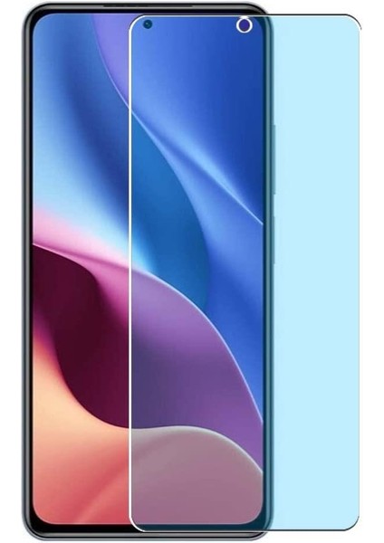 Redmi Note 12 Mat Esnek Nano Ekran Koruyucu