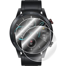 IPG Honor Magic Watch 2 46 mm Akıllı Saat Ekran Koruyucu (2 Adet)