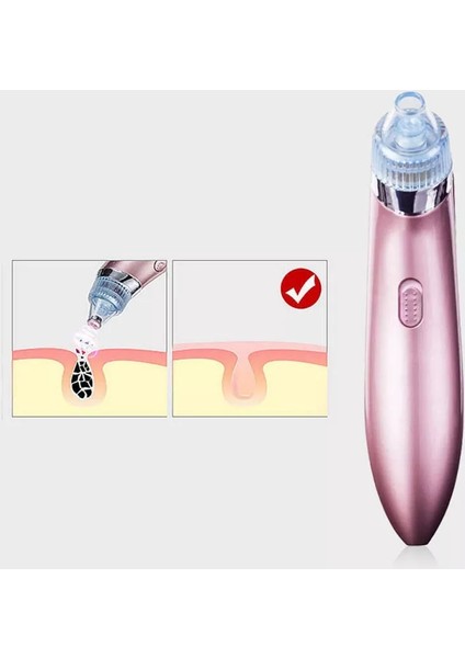 Vakumlu Siyah Nokta Yüz Temizleme Cihazı modelleri