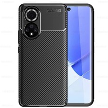 Microcase Huawei Nova 9 Maxy Serisi Carbon Fiber Silikon Kılıf - Siyah AL3413