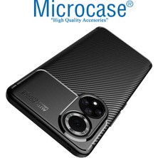 Microcase Huawei Honor 50 Maxy Serisi Carbon Fiber Silikon Kılıf - Siyah AL3413