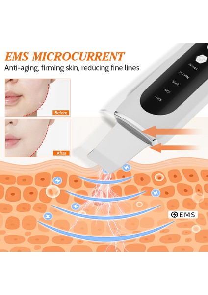 Ultrasonik Cilt Yıkayıcı Soyma Siyah Nokta Sökücü Yüz Kaldırma Derin Yüz Temizleme Iyon Ance Gözenek Temizleyici Yüz Kürek Temizleyici (Yurt Dışından) fırsatları
