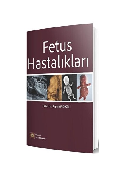 Fetus Hastalıkları