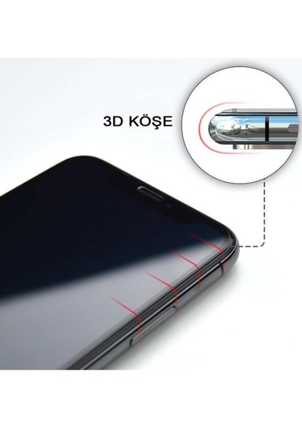 Xiaomi Redmi Note 8 Pro Kılıf Baskılı Arka Kapak - Iskelet Aşk +Tam Ekran Koruyucu
