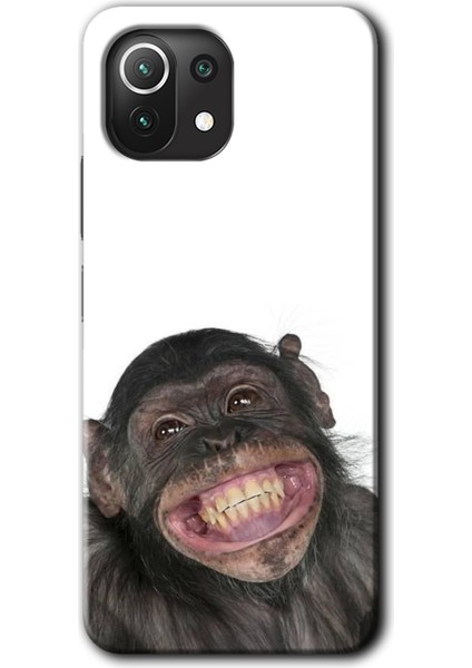 Xiaomi Mi 11 Lite Kılıf Baskılı Kapak - Şıpsevdi Aşk +Tam Kaplayan Mat Seramik