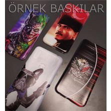 Omix X400 Kılıf Minjae Lee Baskılı Desenli Silikon Kapak STK-576