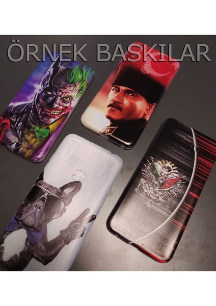 Omix X400 Kılıf Vektör Tasarım Baskılı Desenli Silikon Kapak STK-533