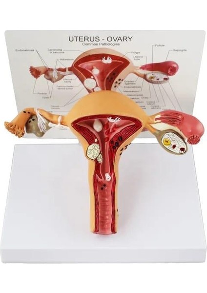 Uterus Pelvik Taban Maketi Model 41