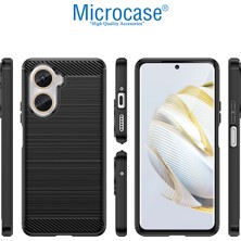 Microcase Huawei Nova 10 Se Brushed Carbon Fiber Silikon Kılıf - Siyah AL3332