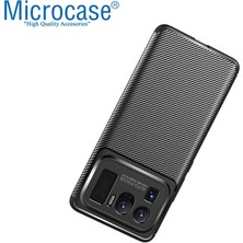 Microcase Xiaomi Mi 11 Ultra Maxy Serisi Carbon Fiber Silikon Kılıf - Siyah AL3413