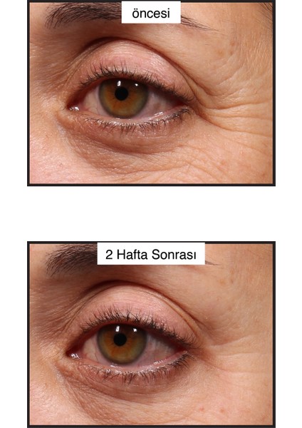 Retinol Youth Renewal Eye Serum 15ml fiyatları