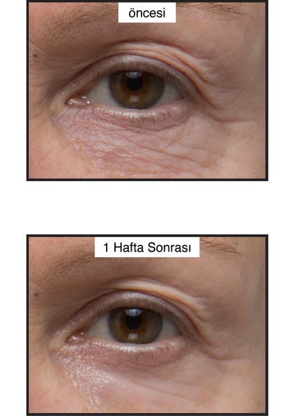 Renewing Eye Cream - Kırışıklıklara Karşı Göz Kremi