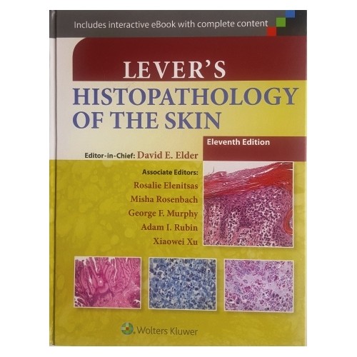 Lever's Histopathology Of The Skin David E. Elder Kitabı