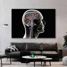 SML Tablo Beyin Yapısı Röntgen Beynin Filmi Nöroloji Kanvas Tablo