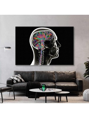 SML Tablo Beyin Yapısı Röntgen Beynin Filmi Nöroloji Kanvas Tablo