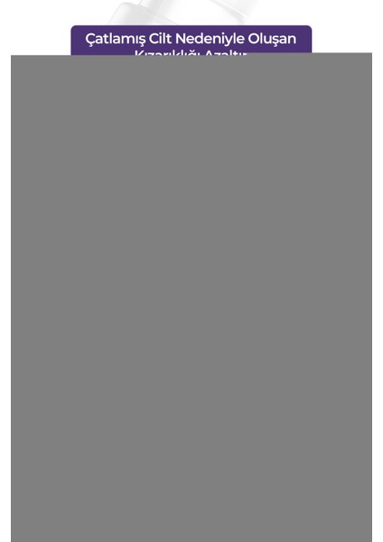 Çatlak Görünümü Ve modelleri