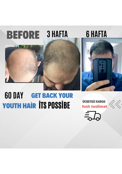 Hair Mavi Serum bakım serumu 1x50ml