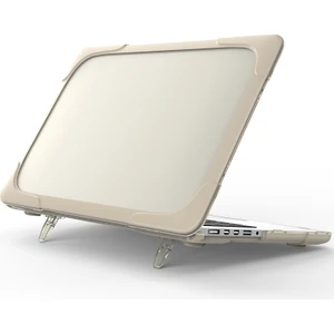Xfashion Macbook Pro 15 Inç/pro Retina 15 Inç A1398 (Yurt Dışından)