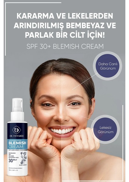 Cilt Leke Kremi +30 Spf