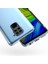 Xiaomi Redmi Note 9 Kamera Korumalı Şeffaf Kılıf + Ekran Koruyucu 5