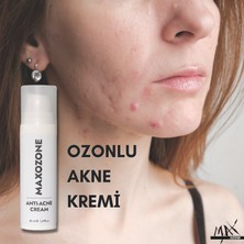 Maxozone Anti Akne Krem 30 ml