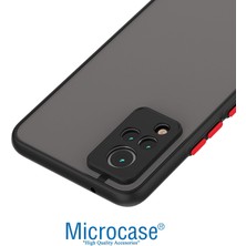 Microcase Microcase Vivo V21 London Serisi Darbeye Dayanıklı Kılıf - Buzlu Siyah AL3415