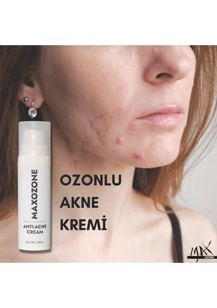 Anti Akne Krem 30 ml