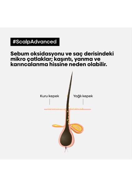 Serie Expert Scalp Advanced Kepek Karşıtı Profesyonel Şampuan 500 ml