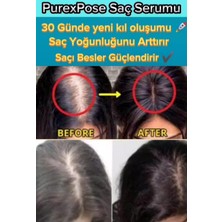 Purexpose Saç Bakım Serumu & Losyon 1ADET