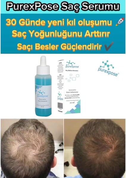 Saç Bakım Serumu & Losyon 1ADET