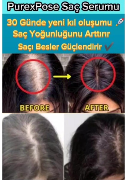 Saç Bakım Serumu & Losyon 1ADET