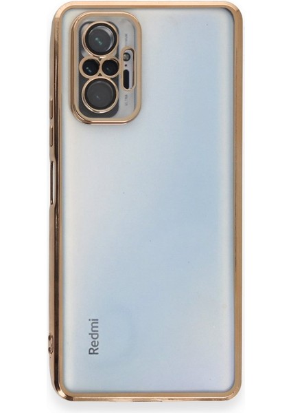 Redmi Note 10 Pro Kılıf 3D Kamera ve Lens Mercek Korumalı Ultra Lüks Razer Plating Silikon Case