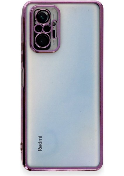 Redmi Note 10 Pro Kılıf 3D Kamera ve Lens Mercek Korumalı Ultra Lüks Razer Plating Silikon Case